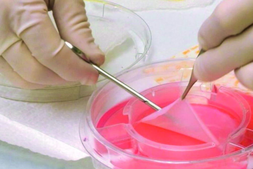Bioimpresión 3D